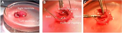 Preparing Excitable Cardiac Papillary Muscle and Cardiac Slices for Functional Analyses